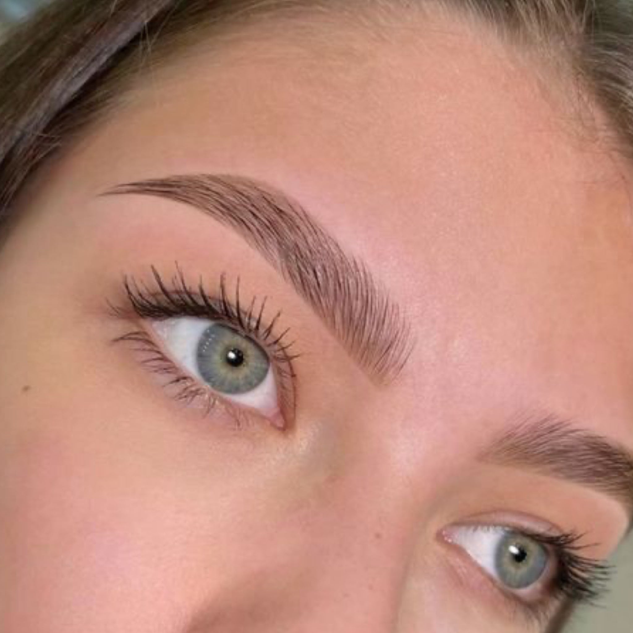 browlift sourcils