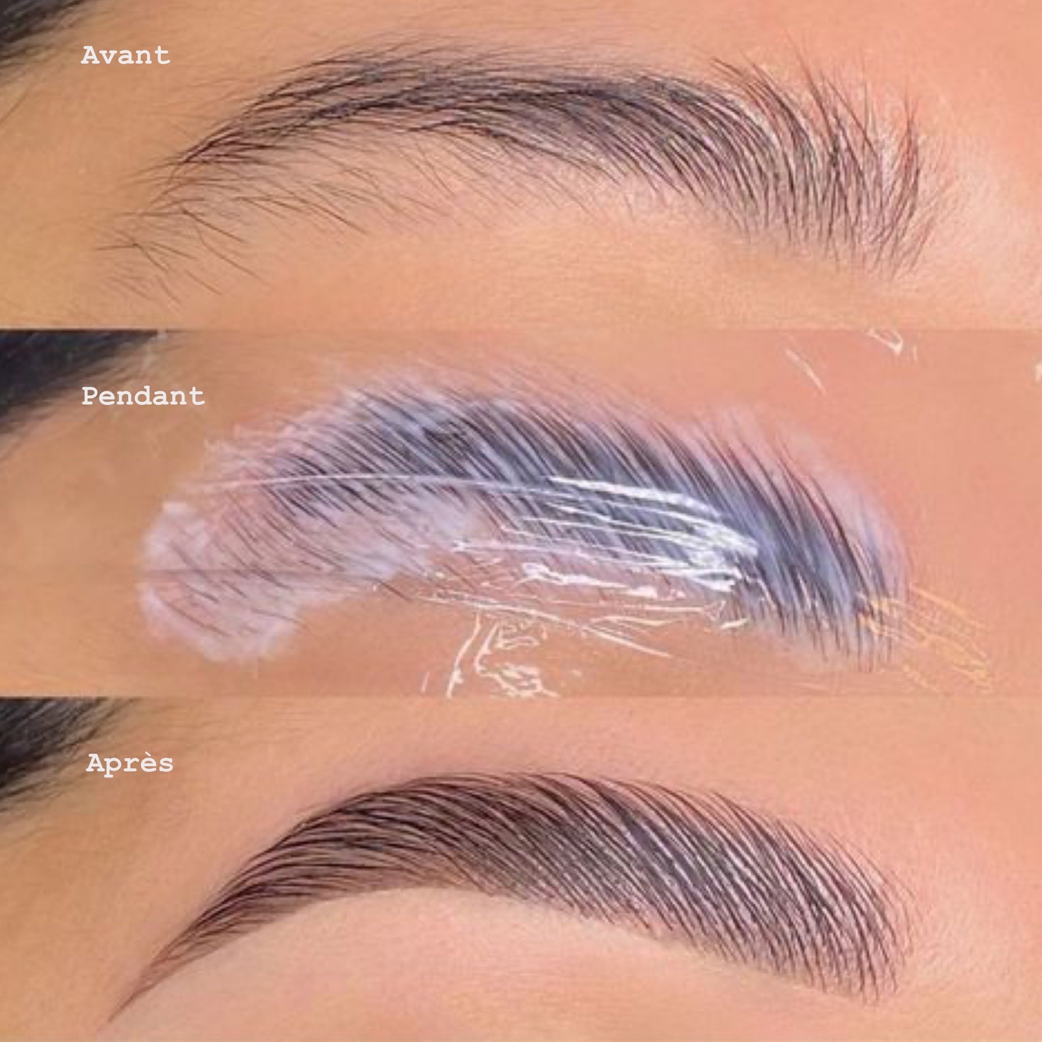 browlift_avant_apres