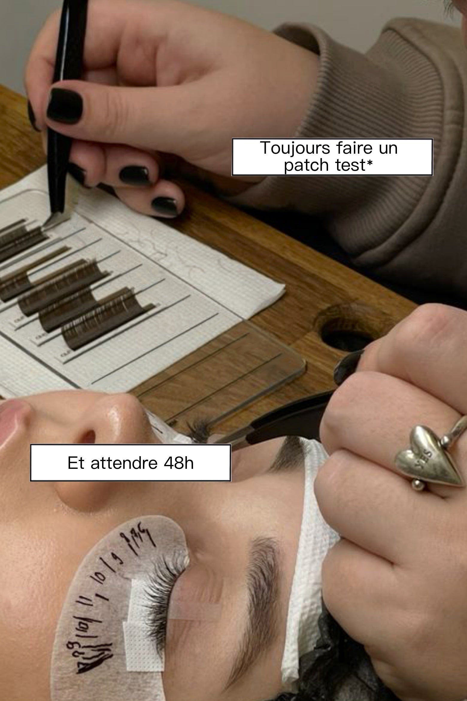 colle sans cyano acrylate patch test
