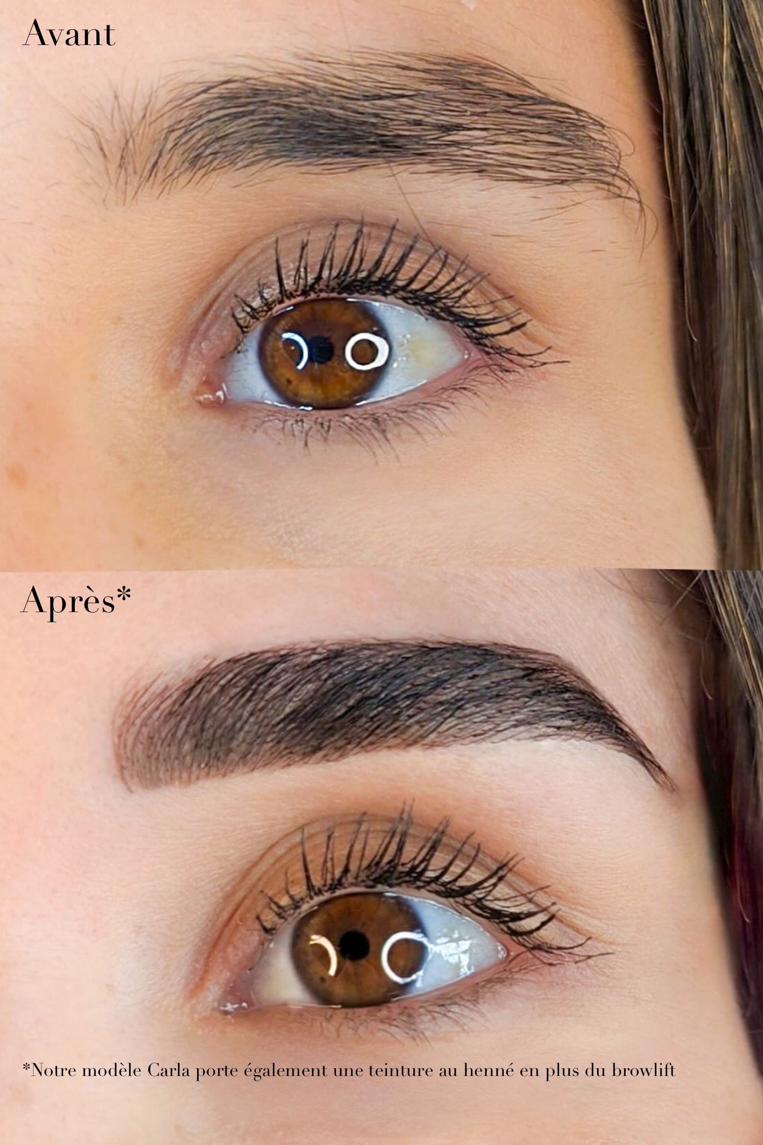 Avant apres browlift resultat
