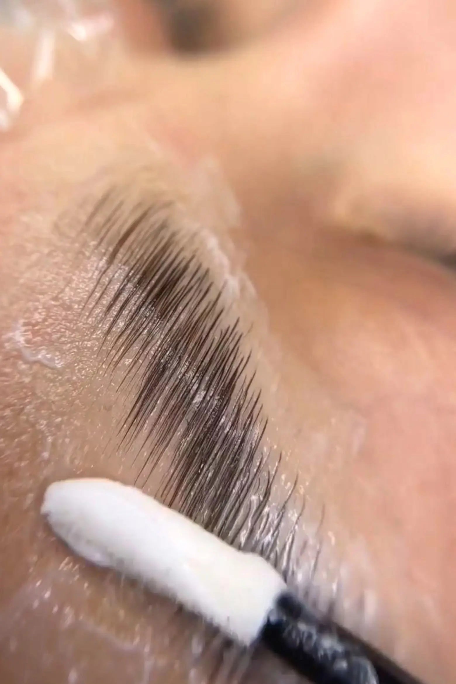 temps de pose kit browlift